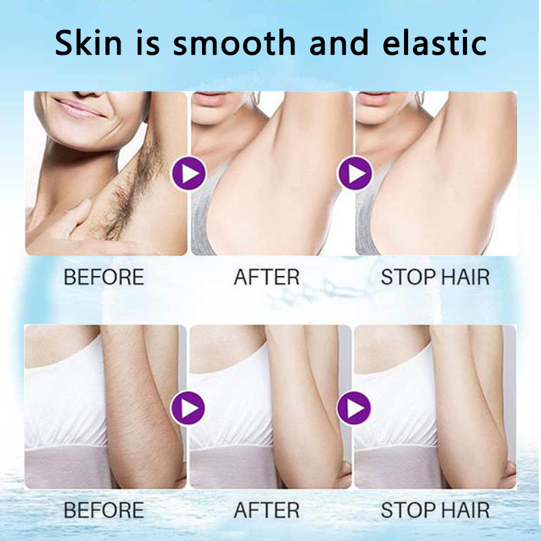 đ„ Magic Hair Removal & Hair InhibitorăBuy 5+ Get Extra 25% OFFă