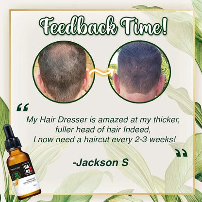 10X-Regro Strong Hair Serum - 💯BUY MORE SAVE MORE💯